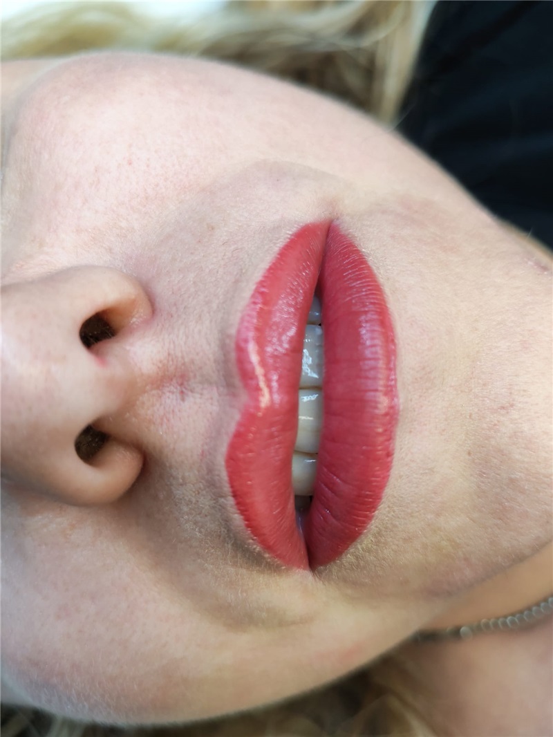 dermopigmentazione Labbra TransLucent Lips