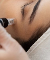 B-Dermapen tonificante